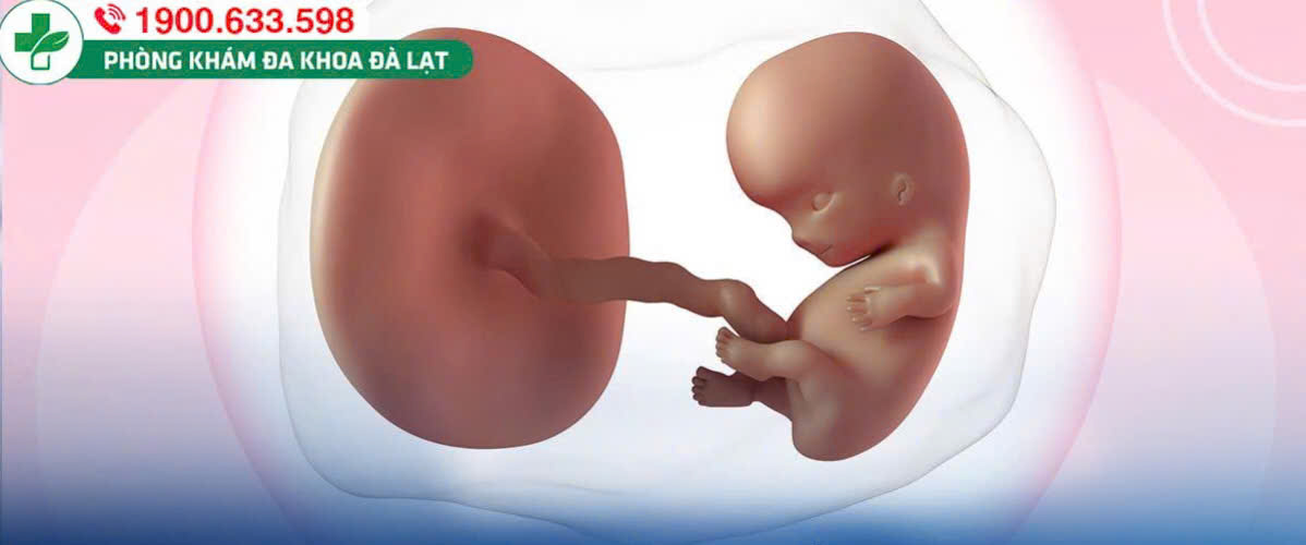 Hình ảnh minh họa