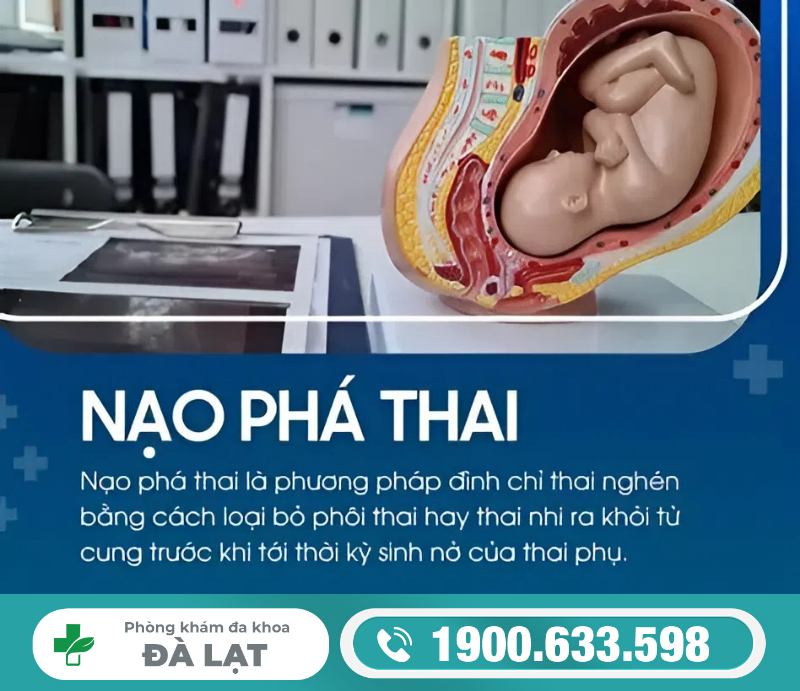 Hình ảnh minh họa