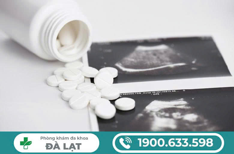 Hình ảnh minh họa